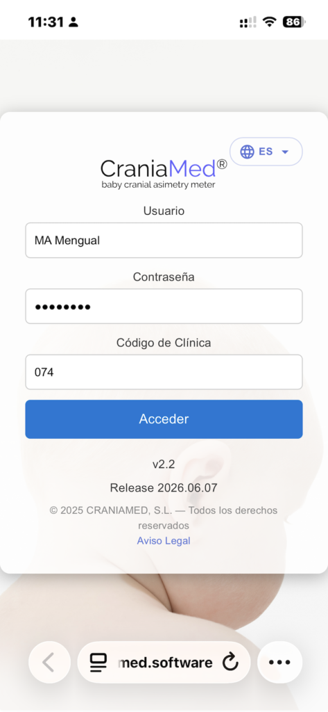 pantalla de login de la aplicacion craniamed