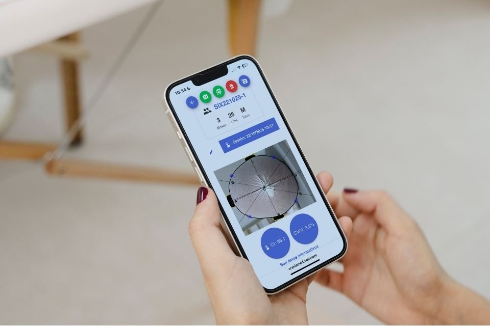 Imagen de Craniamed en la pantalla donde se puede observar los índices CI y CVAI