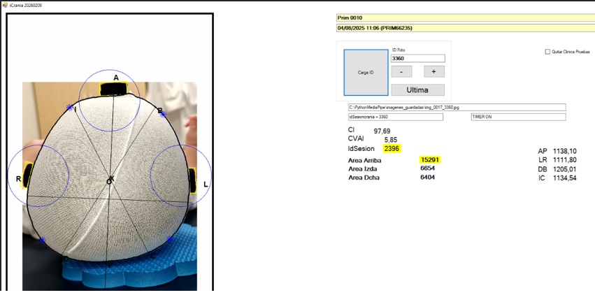 CraniaMed validacion calculo variables CVAI- y CI